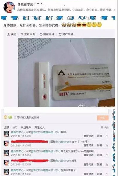 艾滋病检测