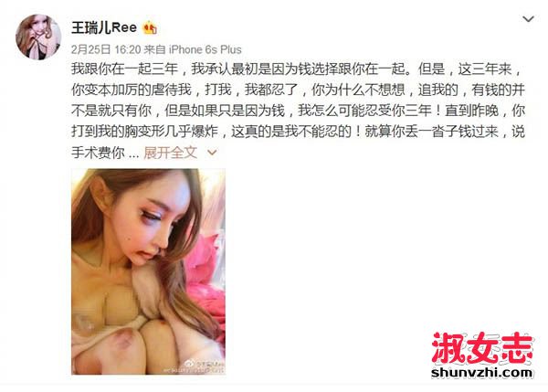 王瑞儿胸被打爆照片 王瑞儿前男友是张爱朋吗